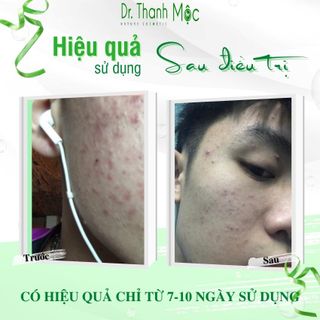 DR THANH MỘC PURE giảm mụn, mờ thâm, cấp ẩm GIÁ SỈ- giá buôn