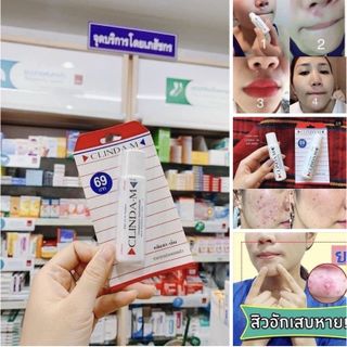 CHẤM GIẢM MỤN CLINDA-M THÁI LAN 15GR (HÀNG CHUẨN)