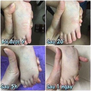 Cao sả nắp đồng lớn 20g