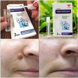 GEL Dvelinil TẨY NỐT RUỒI, MỤN CƠM, MỤN CÓC, SẸO LỒI, THỊT THỪA