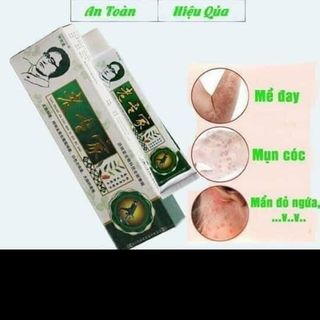 Kem bôi vẩy nến á sừng nội địa Trung