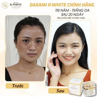 CHUYÊN CUNG CẤP SỈ &LẺ KEM DAKAMI II CHÍNH HÃNG CHECK MÃ QR CAM KẾT CHÍNH HÃNG 100%