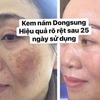 Kem Nám HQ Dong Sung 10g giá sỉ