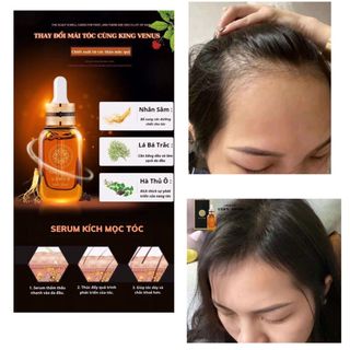 [Chính hãng] COMBO tiết kiệm: Serum dưỡng mi và mày King Venus + Serum kích mọc tóc King Venus
