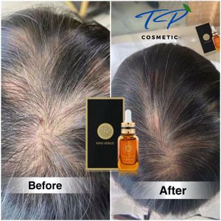 [Chính hãng] COMBO tiết kiệm: Serum dưỡng mi và mày King Venus + Serum kích mọc tóc King Venus