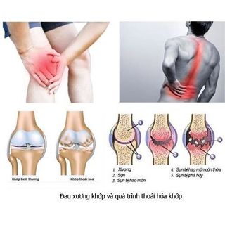 [Chính hãng] Viên uống bổ Xương Khớp Glucosamin Premium: Xương chắc khỏe, Khớp linh hoạt