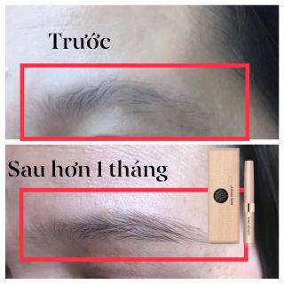 Serum dưỡng mi kingvenus (dưỡng mày mi)