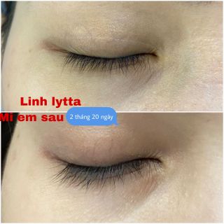 Serum dưỡng mi kingvenus (dưỡng mày mi)