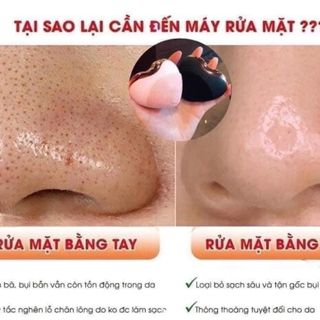 Máy rửa mặt mini đa năng LACO chính hãng