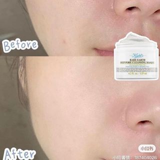 Mặt nạ đất set Kiehls