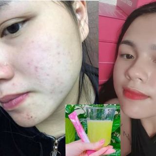 Bena collagen