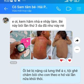 Kem Hăm Cho Bé Hết Hăm Tã, Mẩn Ngứa, Mềm Mát Da Ngay Lần Đầu Sử Dụng, 5g