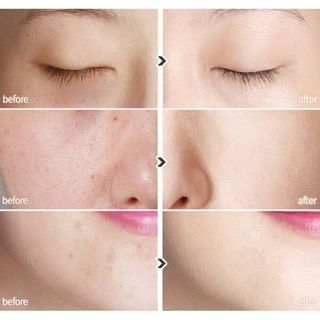 Kem nền BB Cream Aspasia 4U Special Solution SPF50/Pa+++ 50ml