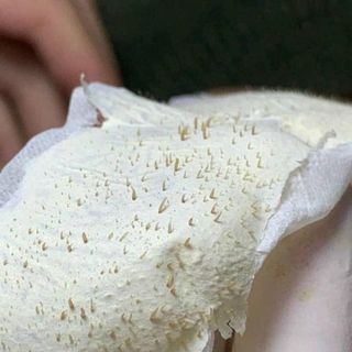 KEO LỘT MỤN HANDMADE