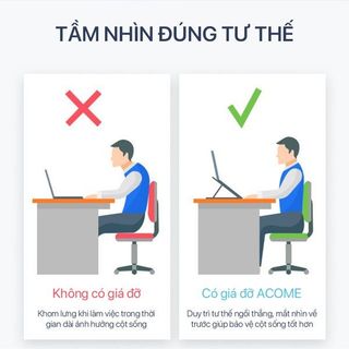 Giá Đỡ Laptop nhôm tản nhiệt gấp gọn ACOME ALS01, kệ đỡ máy tính cao cấp BenZ Store