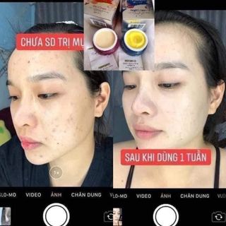 kem face nhật meiduzi ngày đêm
