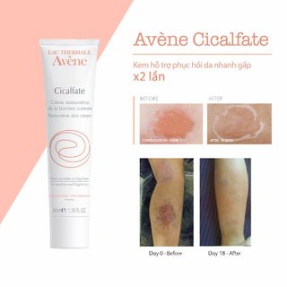 Kem Dưỡng Làm Mờ Sẹo, Phục Hồi Và Tái Tạo Da Avene Cicalfate Repair Cream 40ml/100ml Chính hãng