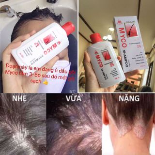 Dầu gộ trị gầu, nấm đầu. Sỉ