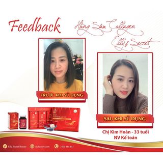 Hồng Sâm Collagen cao cấp Hàn Quốc với hàm lượng cao - cải thiện các vấn đề về sức khỏe và sắc đẹp