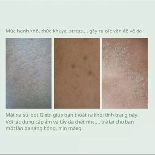 Nạ sủi bọt thải độc