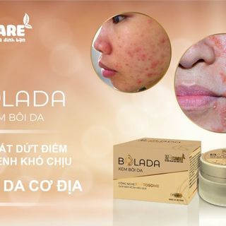 Kem Bôi Ngoài Da Bolada 17Gr - Bạch Dương Care - Mềm Mịn, Giảm Ngứa Mẩn Đỏ Hăm Da Viêm Nấm, Côn Trùng Cắn Nước Ăn Chân