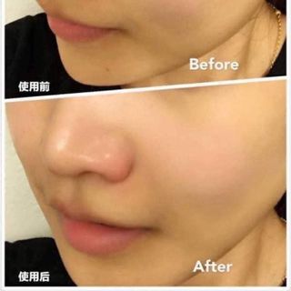 MẶT NẠ THẢI ĐỘC BÌ HEO 𝑪𝑨𝑪𝑩𝑶𝑹𝑵𝑨𝑻𝑬 giá sỉ