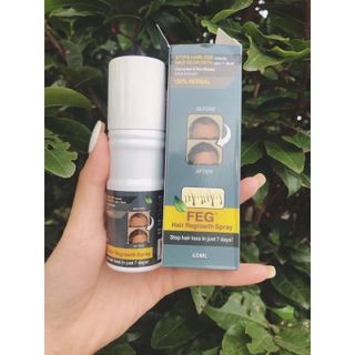 xịt mọc tóc dài dày khỏe mạnh hiệu quả sau 15 ngày sử dụng