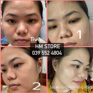 Kem trắng hồng jussmy hmstore