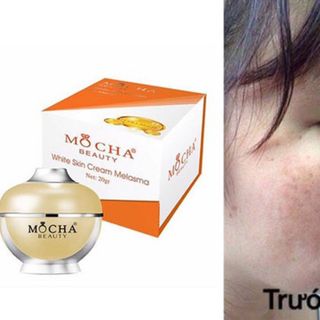 Mỹ phẩm Mocha