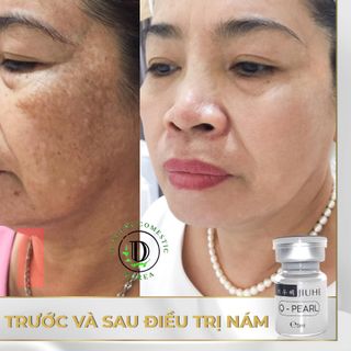 erum trị thâm JIUHE hàng chính hãng 100% SẢN PHẨM TÁI TẠO LÀN DA TRẮNG HỒNG TƯƠI TRẺ. Tái tạo làn da phục hồi và bổ sung các dưỡng chất cho da