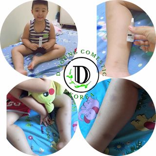 erum trị thâm JIUHE hàng chính hãng 100% SẢN PHẨM TÁI TẠO LÀN DA TRẮNG HỒNG TƯƠI TRẺ. Tái tạo làn da phục hồi và bổ sung các dưỡng chất cho da