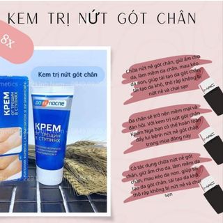 KEM TRỊ NỨT GÓT CHÂN KPEM giá sỉ