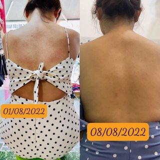 Dầu Argan nguyên chất 10ml - trị mụn, thâm, viêm da cơ địa