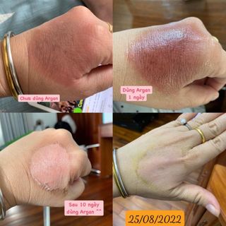 Dầu Argan nguyên chất 10ml - trị mụn, thâm, viêm da cơ địa