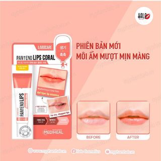 {CHÍNH HÃNG}ưSon Dưỡng Môi Mediheal Khử Thâm, Dưỡng Ẩm Hiệu Quả Labocare Pantenolips 10ml