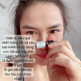 Huyết thanh kích mọc tóc siêu nhanh Weilaiya