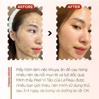 LE'PEAU - PEAU PEEL DA VI TẢO RETINOL