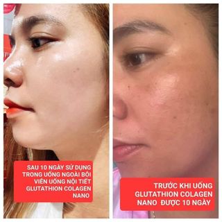 Viên uống đẹp da Glutathione Colagen Nano( tặng kèm 1 lọ serum dưỡng da trong mỗi hộp)