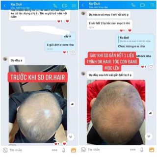 Kích mọc tóc Dr Hair