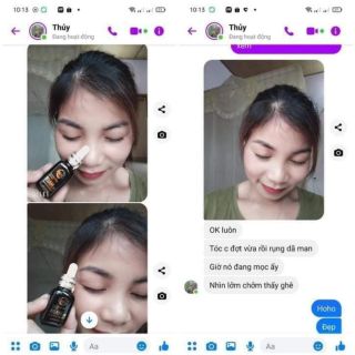 Kích mọc tóc Dr Hair