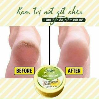 Kem trị nứt gót chân chuối Thái Lan giá sỉ