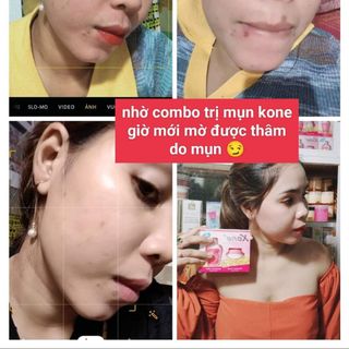 KEM KONE THÁI CHÍNH HÃNG