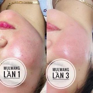 70k / lít .Dầu Baby Oil,Ko Mùi , Giữ Ẩm Da Mịn,
