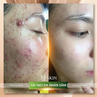 TÁI TẠO DA NHÂN SÂM MQ SKIN