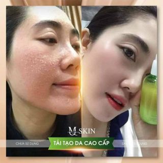 TÁI TẠO DA NHÂN SÂM VIP MQ SKIN