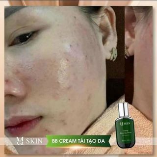 Kem Tái Tạo Da BB Cream MQ Skin