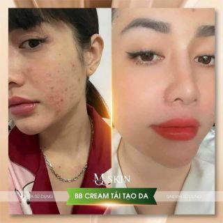 Kem Tái Tạo Da BB Cream MQ Skin