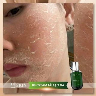Kem Tái Tạo Da BB Cream MQ Skin