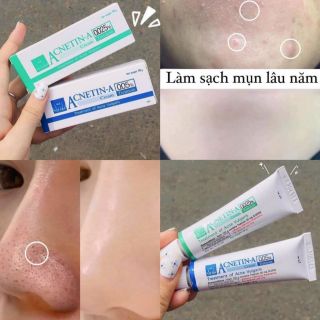 Kem Trị Mụn Acnetin-A