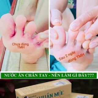 KEM BÔI DA THUẦN MỘC